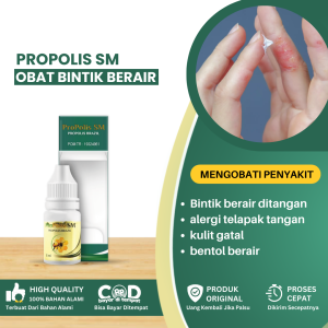 Obat Bintik Berair Di Telapak Tangan Obat Alergi Telapak Tangan Obat Penghilang Gatal Dan Bintik Berair Di Telapak Tangan Obat Kulit Gatal Bentol Berair Obat Kutu Air Alergi Deterjen - Propolis Sm