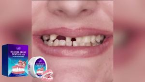Oralhoe Dentures to modify braces Dental prosthetics for teeth modification enhancing smile comfort care kit