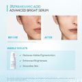 ♠100 Ori SKINTIFIC 3 Tranexamic Acid Advanced Bright Serum Fade Dark Spot Brightening Skin Serum Alpha Arbutin Serum❧. 