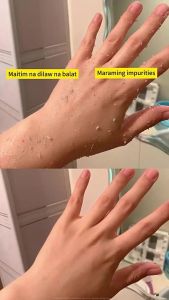Buy 1 Take 2 LBLS Exfoliating Gel Dead Skin Remover Deep Clean Brightening Smooth Skin Face