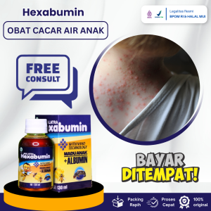 Obat Cacar Air Anak Obat Cacar Air Bernanah Obat Penghilang Gatal Cacar Anak Obat Cacar Berair Anak Obat Pengering Cacar Anak Obat Cacar Air Gatal Dan Perih Ruam Kulit Anak Dengan Hexabumin