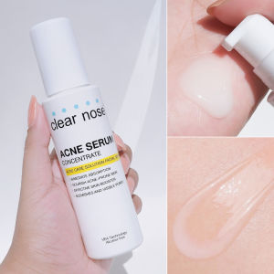 Clear Nose Acne Serum Concentrate 100ml | Alcohol-Free Acne Care Facial Essence | Instant Fast Absorbing Texture | Nourish Acne-Prone Skin | Shrink Visible Pores | Clear Blemishes & Breakouts