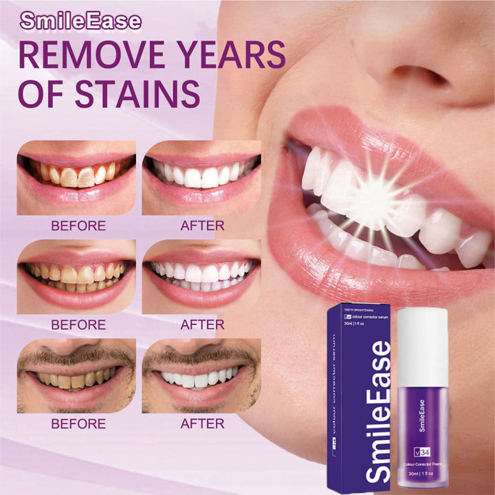 Smile Ease Toothpaste V34 Colour Correct Whitening Teeth Tartar Plaque ...