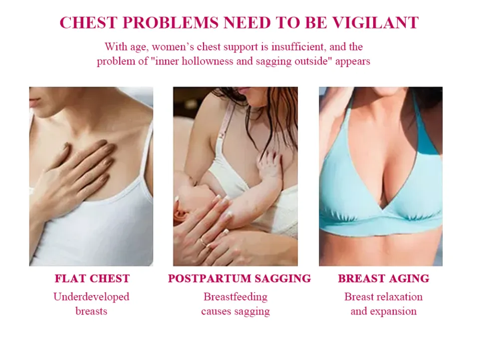 Kokovifyves Tighten The Chest, Improve The Breast, Prevent Breast