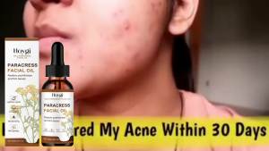 📱 Follow the Store 📱 Hoygi Facial Care Oil Improves Skin Dullness Moisturizing Rejuvenating Brightening Facial Skin Care Essential Oil