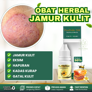 Obat Gatal Jamur Eksim Hapuran Kadas Kurap Gatal Kulit Badan Alergi Untuk Anak Dan Dewasa - Propolis SM