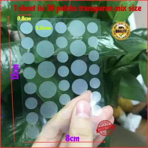 ORI 100% EELHOE Acne Patch bintang tidak terlihat pinset jerawat/Stiker Jerawat Patch hidrokoloid Acnes penghapusan jerawat Patch penyamar Jerawat stiker perawatan wajah