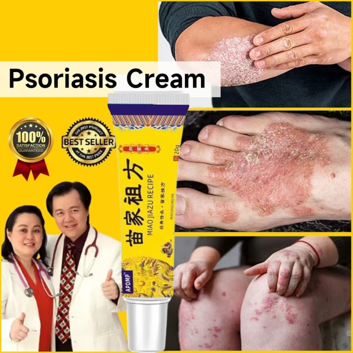 Psoriasis Eczema Treatment Cream 20g For the treatment of skin ...