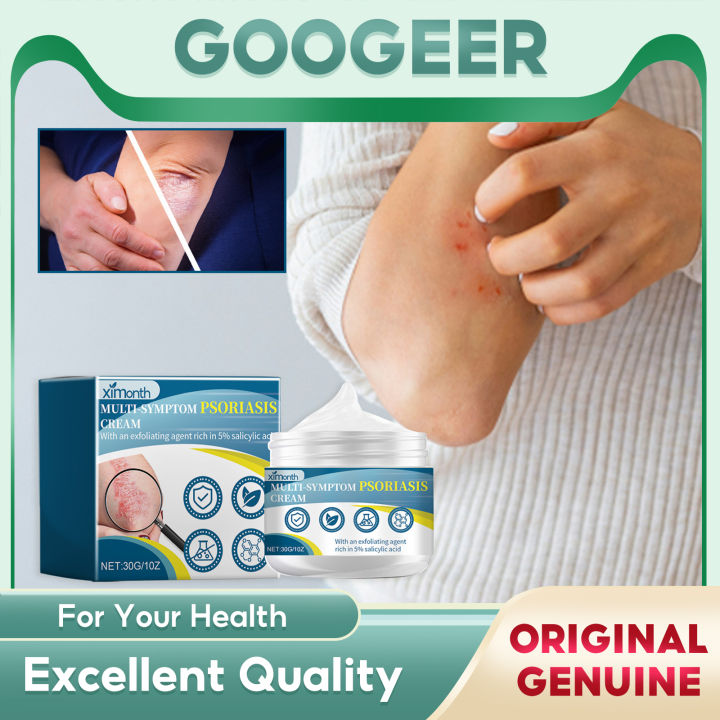 Ximonth Multi Symptom Psoriasis Ointment Antibacterial Anti Itchy ...