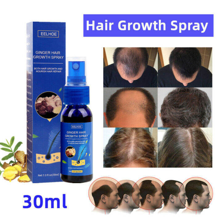 Penumbuh Rambut - EELHOE Hair Growth Spray Cairan Serum Rontok Penyubur ...