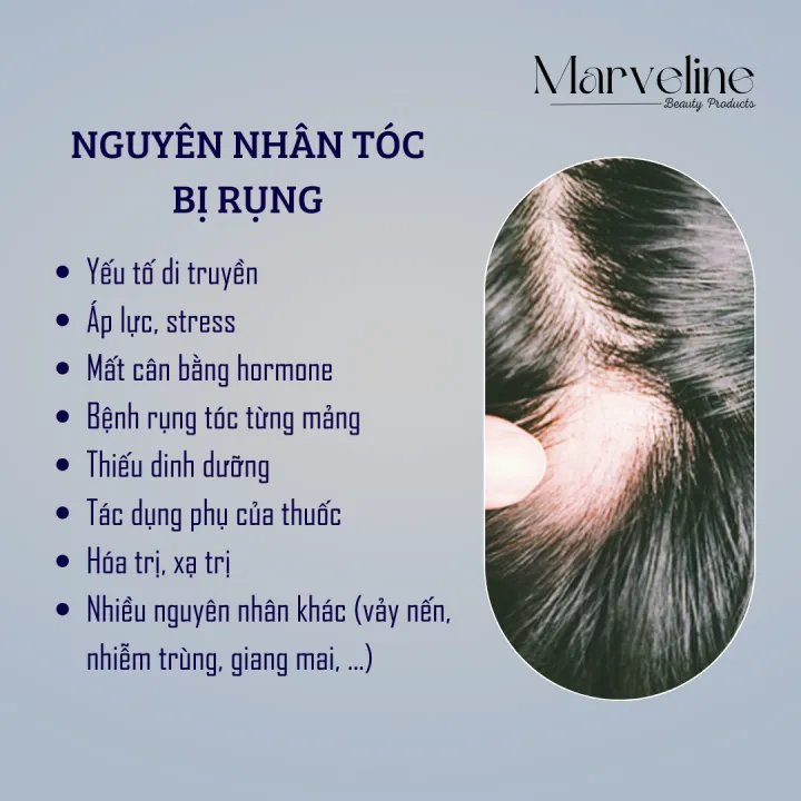 Tinh%20ch%E1%BA%A5t%20kh%E1%BA%AFc%20ph%E1%BB%A5c%20r%E1%BB%A5ng%20t%C3%B3c%20Kaminomoto%20Higher%20Strength%20Nh%E1%BA%ADt%20B%E1%BA%A3n%20ch%C3%ADnh%20h%C3%A3ng%20-%20Image%203