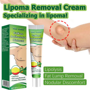 Authentic Lipoma Removal Cream Original Lipoma Cream Original Quickly Eliminate Fat Lump Tendon Sheath Cyst Subcutaneous Cyst and Fat Granule Lipoma Cream 20g