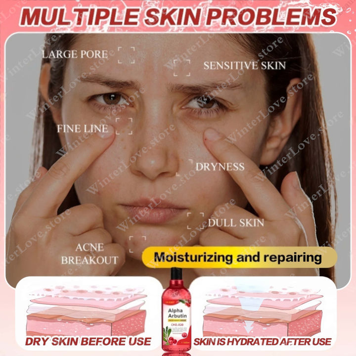 BUY%201%20TAKE%201%20500ml%20Arbutin%20Body%20Serum%20For%20Skin%20Whitening%20Brightening%20Niacinamide%20To%20Improve%20Dull%20Skin%20Tone%20Serum%20For%20Face%20Skin%20Care%20Essence%20Acne%20Skin%20Repair%20Moisturizer%20Whitening%20Bleaching%20Lotion%20Underarm%20Gentle%20Firming%20Repair%20Skin%20-%20Image%205