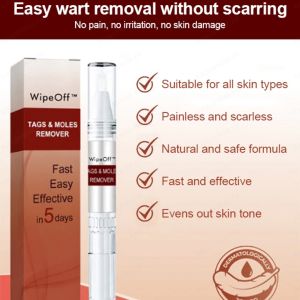 Penghilang tahi lalat Penghilang kutil di leher dan wajah Skin tag remover Untuk Semua Kulit