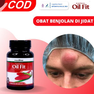 Obat Benjolan Di Jidat Obat Benjolan Keras Di Jidat Obat Benjolan Di Dahi Penghancur Benjolan Besar Kecil Obat Benjolan Di Kepala Obat Benjolan Di Dahi Sebelah Kanan/ Kiri Dengan OilFit