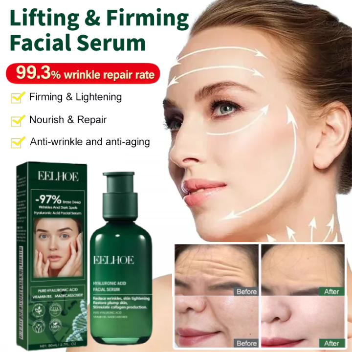 EELHOE Green Bottle Hyaluronic Acid Facial Serum Anti-Aging Wrinkle ...