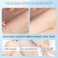 Niacinamide Exfoliating Gel 250g Facial Body Scrub Deep Clean Blackhead Removal Exfoliating Gel Whitening Skin Peeling Cream Niacinamide Body Whitening Scrub Brightens Moisturizes Exfoliating Gel Gentle Pimple Removal Mud Rubbing Treasure Bathe. 