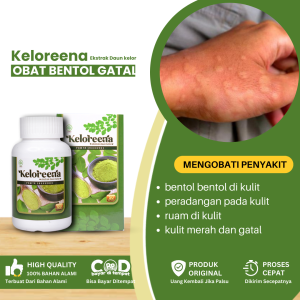 Obat Bentol Dan Gatal Obat Biduran Obat Kaligata Gatal Gatal Obat Biduran Menahun Obat Kaligata Obat Peradangan Pada Kulit Obat Bentol Bentol Di Kulit Ruam Di Kulit Ruam Merah Alergi Kulit Obat Alergi Dingin Dengan Keloreena