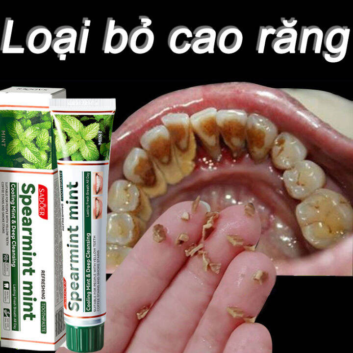 Công dụng của kem đánh răng trong việc trị vôi răng