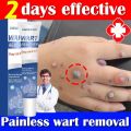 warts remover cream original painless 20g Warts Magic Remover Wartz Removal Cream Warts Remover Skin Kulugo Remover Skin Growth Warts Remover Mole And Warts Remover warts remover cream ointment warts remover original. 