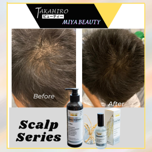 ❤️Ready Stock❤️Takahiro Scalp Tonic 100ml + Scalp Shampoo 300ml Hair Loss Control  Shampoo tonic Anti Hair Fall  Treatment Oil 现货热卖 改善頭皮 脱发 控油 头皮屑 头皮痒 防脱育发洗发水