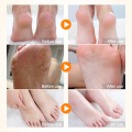 krim kaki pecah dan kering collagen Foot cream kaki pecah Pelembab kaki kering dan pecah Penghalus kaki kasar dan pecah Ultra Pelembab Obat Tumit Kaki Dan Tangan Kering Cream Tumit Kaki Pecah Dan Kering Salep Penghilang Pecah Pecah Di Kaki. 