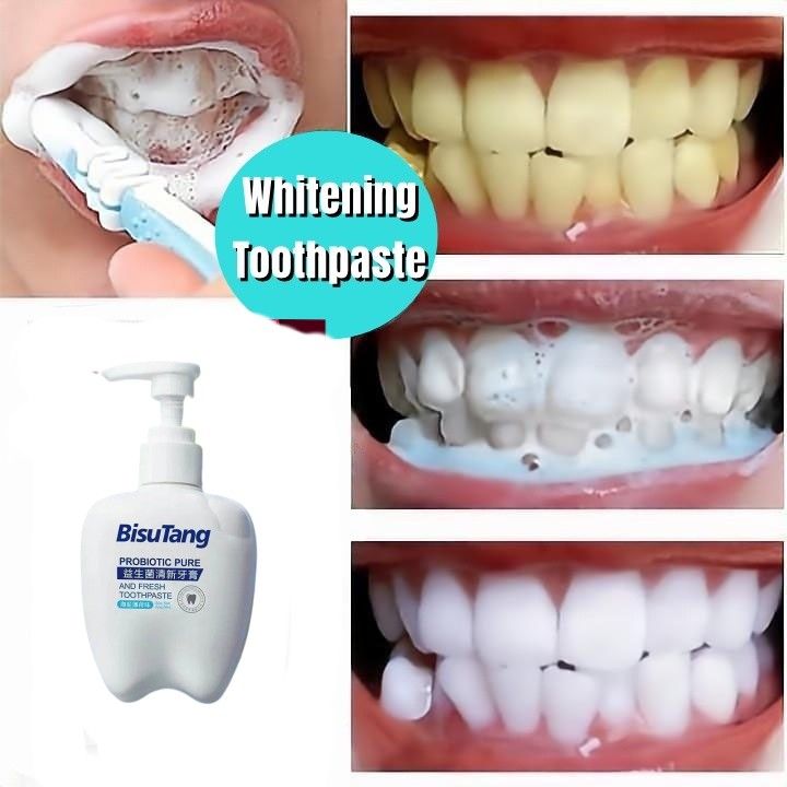 Pasta gigi pemutih Pasta gigi angkat karang Pemutih gigi kuning