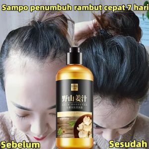 shampo penumbuh rambut cepat Anti rambut rontok Botak ginger shampoo 300ml kontrol minyak menyegarkan pelembab nutrisi Treatment Anti Rambut Rontok 300ML