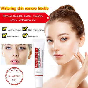Whitening Anti-Freckle Cream/Brightening Spot Removal Cream/Anti-Aging Moisturizing Face Cream/Dark Spot Corrector for All Skin Types