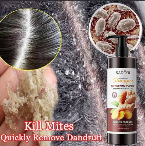 sampo anti ketombe dan gatal shampoo anti ketombe sampo anti ketombe