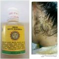 Obat Kutu Rambut Paling Ampuh OBAT KUTU RAMBUT AMPUH DAN TELUR KUTU PEMBERSIH KUTU RAMBUT PEMBASMI KUTU RAMBUT PENGHILANG KUTU RAMBUT. 