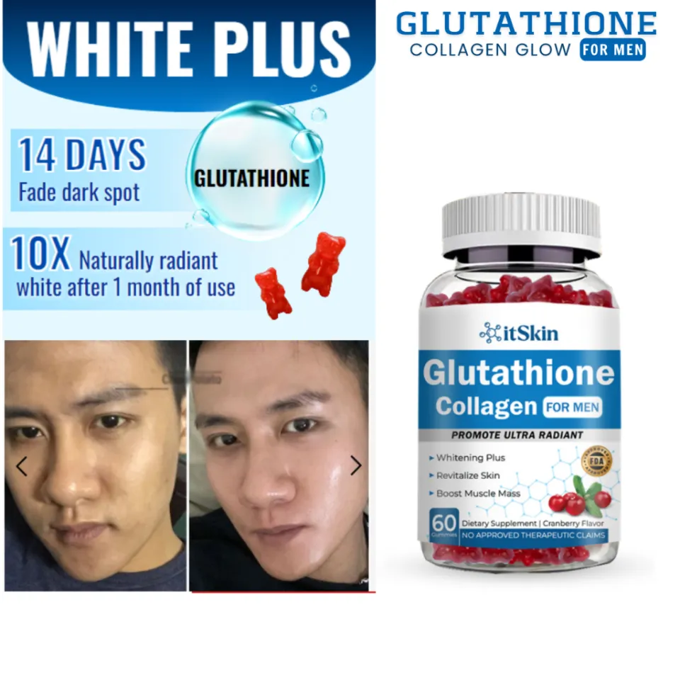 it skin glutathione collagen for men review Itskin Glutathione Collagen Glow Gummies for Men Original Anti-Aging Whitening Skin Good for heart