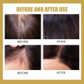 Eelhoe Hair Regrowth Shampoo Powder Ginger Strong Anti-Hair Loss Moisturizing Deep Cleansing Anti-Itching Non-Irritating Shampoo Powder Stimulate Hair Roots And Hair Improve Scalp Blood Circulation Hair Care 10pcs. 