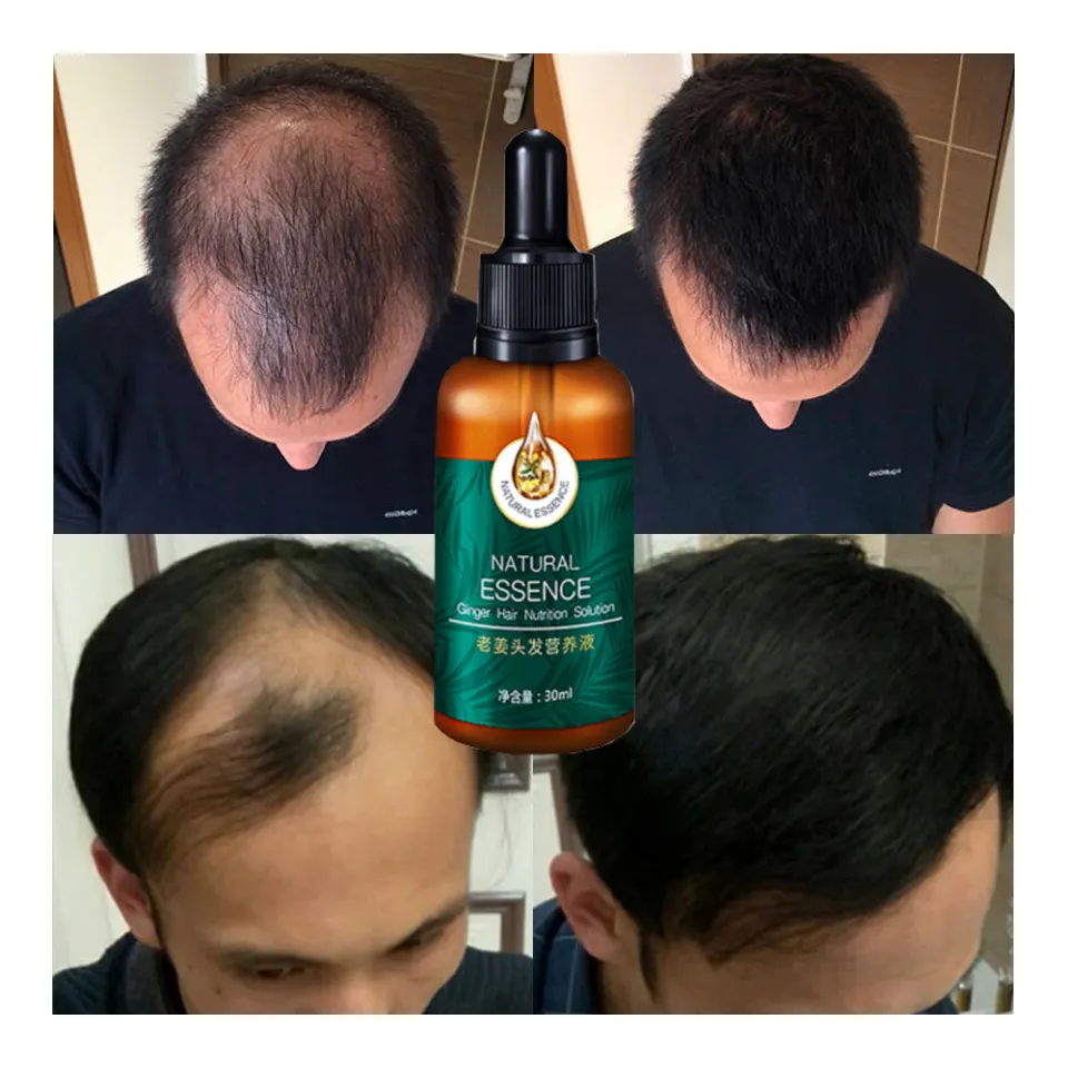 Thuốc mọc tóc Sato Arovics Solutions 5% Nhật Bản 30ml