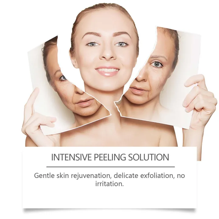 West%20Month%20Intensive%20Peeling%20Solution%20Soothes%20Skin%20Softens%20Texture%20Refines%20Pores%20Appearance%20Skin%20Care%2030ml%20-%20Image%205