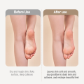 Xiaomi ShowSee เครื่องขัดส้นเท้าไฟฟ้า Electric Foot Grinder เครื่องบดเท้าไฟฟ้า ที่ขัดเท้าลบผิวแคลลัส USBชาร์จ. 