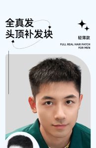 Wig tao ulo patch balding patch humihinga at walang trace buhok noo