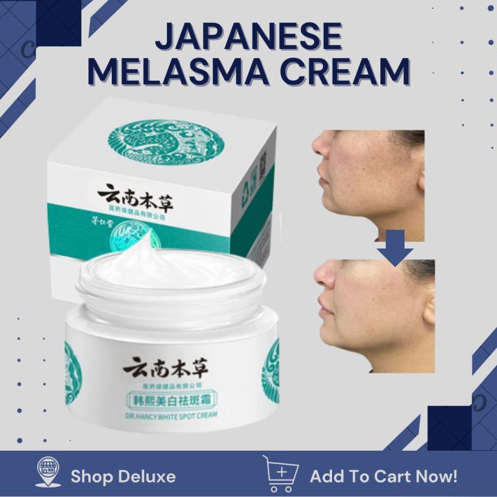 Japanese Melasma Cream Original High Moisturizing Blemish Cream