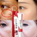 Original Whitening Freckle Cream Pekas Remover FOR ALL SKIN TYPES Melasma Remover Oitment Melasma Cream Pantanggal ng Pekas Pantanggal ng Melasma. 