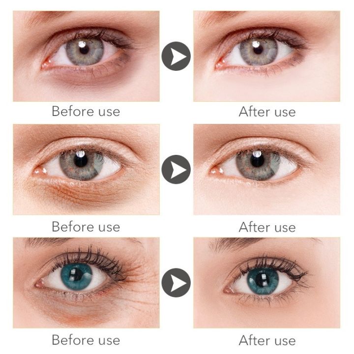 %E3%80%90COD%E3%80%91Eye%20cream%20remove%20repair%20fat%20particles%20eye%20wrinkles%20bags%20under%20the%20eyes%20dilute%20dark%20circles%2020g%20-%20Image%203