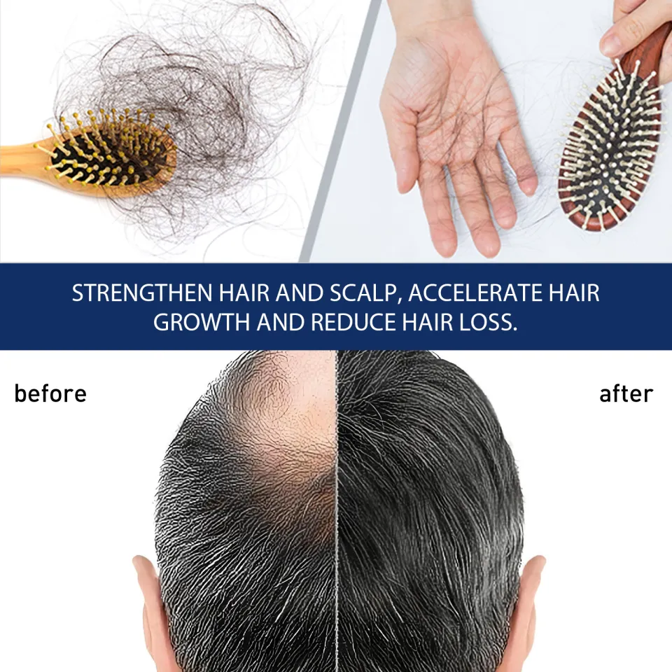 South Moon Alopecias Hair Growth Cream Anti Hair Loss Moisturizes