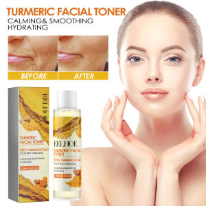 EELHOE Dark Spots Removal Toner Whitening Spots Corrector Remove Freckle Lighten Melasma Pigmentation Moisturizing Turmeric Face Toner Tumeric Dark Spots Toner Spots Eraser Corrector Turmeric Fade Blemishes Dark Spot Remover Acne Remover Toner for Dark