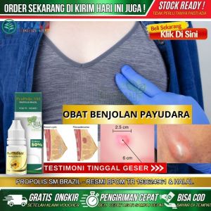 Obat Alami Tumor Payudara Salep Pengering Luka Kanker Benjolan Lemak Pada Payudara Sebelah Kiri Kanan Tumor Jinak / Ganas Di Payudara Penghancur FAM PD Pengecil Kelenjar Getah Bening Bengkak Menghilangkan Daging Menonjol - Propolis Herbal