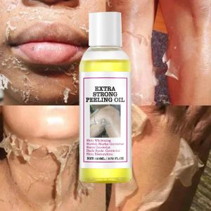 new Yellow Peeling Lotion Oil 100% Organic Bleaching Dark Skin Exfoliating Whitening Nourishing Hyaluronic Acid Moisturiz Body Scrub hot