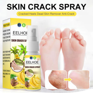 Eelhoe Skin Crack Spray Natural Banana Coconut Foot Repair Spray Remove Dead Skin Moisturizing Heel Prevent Dry Crack Relieve Smooth Foot Care（50ml）
