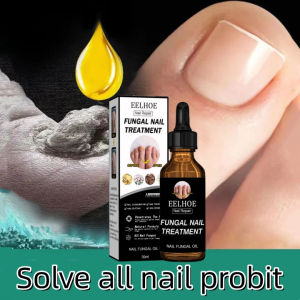 Dưỡng hư móng Essence cứng móng phục hồi móng Mỏng Chẻ Nấm Móng 30ml