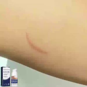 West Month Scar Lightening Gel Repair damaged skin reduce scars smooth skin care gel