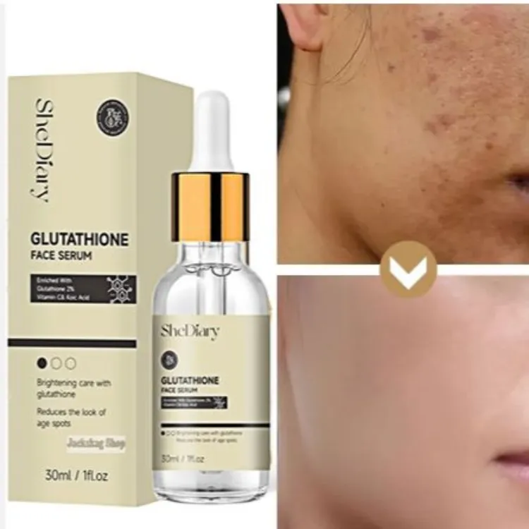 SheDiary Glutathione Whitening Freckle Serum Remove Melasma Dark Spots Face Whitening Serum with Vitamin C Kojic Acid 30ml Niacinamide & Kojic Acid Formula - Lazada | Lazada PH SheDiary Glutathione Whitening Freckle Serum Remove Melasma Dark Spots Face Whitening Serum with Vitamin C Kojic Acid 30ml Niacinamide & Kojic Acid Formula - Lazada | Lazada PH
