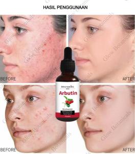[MOOYAM] ARBUTIN BRIGHTENING SERUM - MENYAMARKAN & MENCERAHKAN FLEK HITAM  30ml