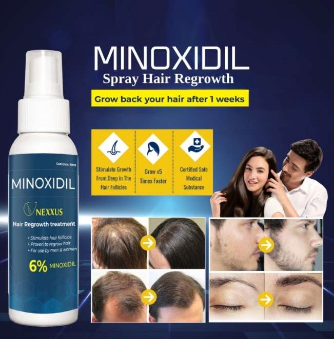 Minoxidil Strands 6% Minoxidil Topical Solution (60ml per bottle) Hair ...